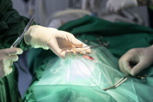 Operation